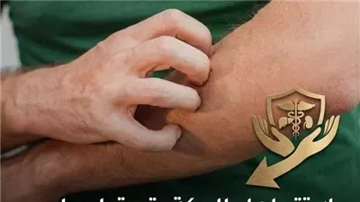حكة الجلد أسباب شائعة من البشرة