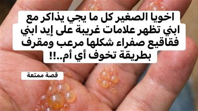 السر في الفقاقيع 
